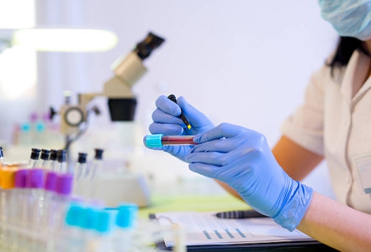 What Are the Most Commonly Used Chemicals Raw Material-_2