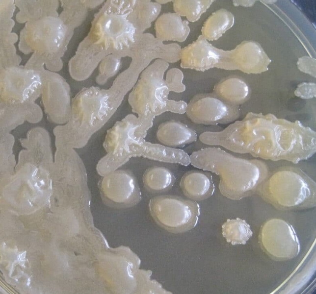 why are bacteria used in sewage treatment_1