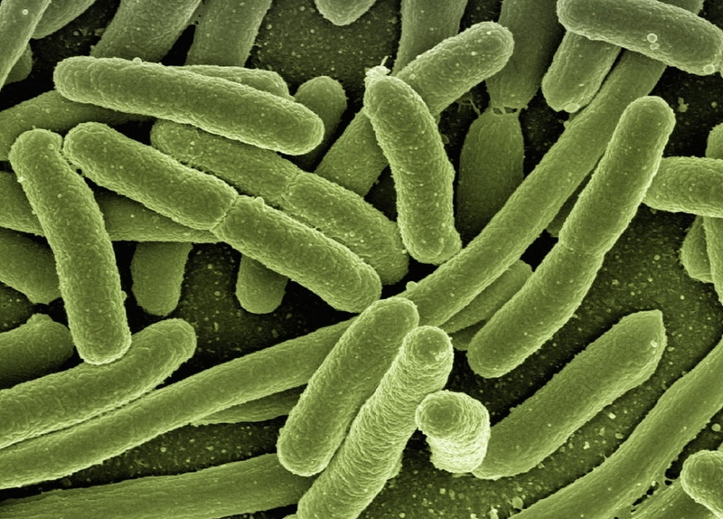 which microbes are used in sewage treatment-_3